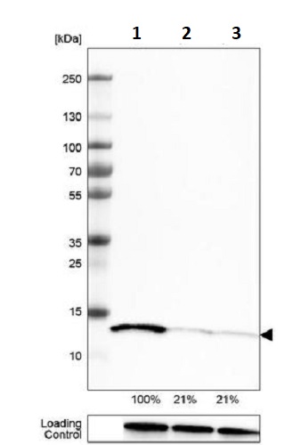 Western blot - Anti-Profilin 1 antibody [CL3524] (ab242369), expandable thumbnail