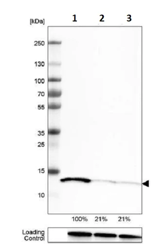 Western blot - Anti-Profilin 1 antibody [CL3524] (AB242369)