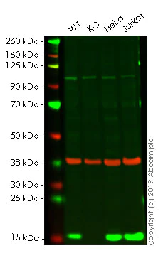 Western blot - Anti-Profilin 1 antibody [EPR6303] (AB133529)