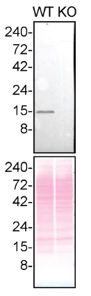 Western blot - Anti-Profilin 1 antibody [EPR6303] (AB133529)