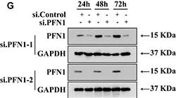 Western blot - Anti-Profilin 1 antibody [EPR6303] (AB133529)