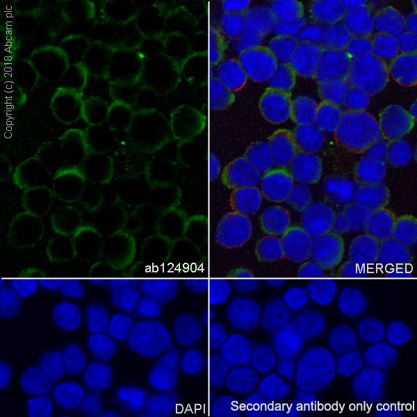 Immunocytochemistry/ Immunofluorescence - Anti-Profilin 1 antibody [EPR6304] (AB124904), expandable thumbnail
