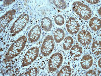 Immunohistochemistry (Formalin/PFA-fixed paraffin-embedded sections) - Anti-Profilin 1 antibody [EPR6304] (ab124904), expandable thumbnail