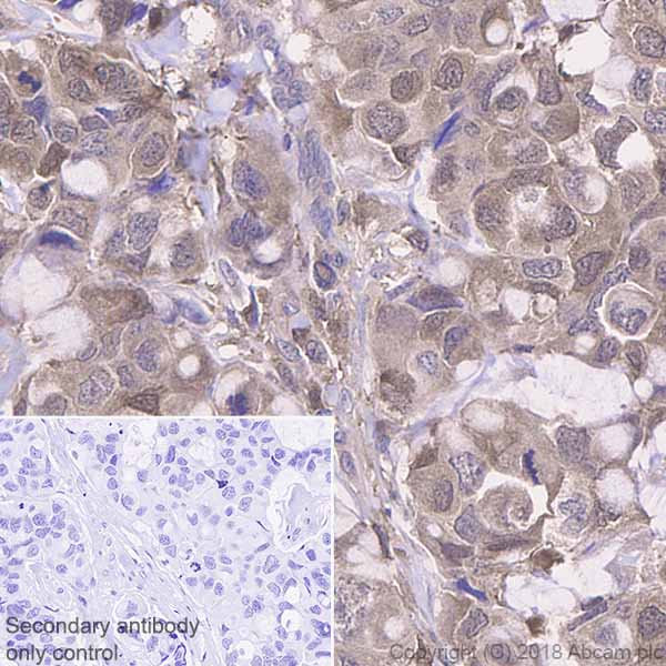 Immunohistochemistry (Formalin/PFA-fixed paraffin-embedded sections) - Anti-Profilin 1 antibody [EPR6304] (AB124904), expandable thumbnail