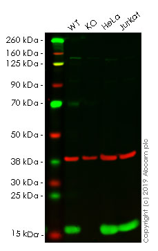 Western blot - Anti-Profilin 1 antibody [EPR6304] (AB124904), expandable thumbnail
