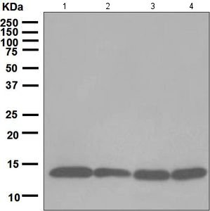 Western blot - Anti-Profilin 1 antibody [EPR6304] (ab124904), expandable thumbnail
