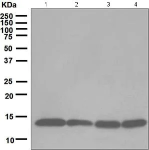 Western blot - Anti-Profilin 1 antibody [EPR6304] (AB124904)