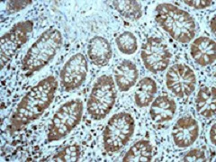 Immunohistochemistry (Formalin/PFA-fixed paraffin-embedded sections) - Anti-Profilin 1 antibody [EPR6304] - BSA and Azide free (AB232020)