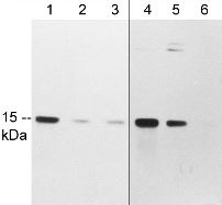 Western blot - Anti-Profilin 1 (phospho S138) antibody (AB215752), expandable thumbnail