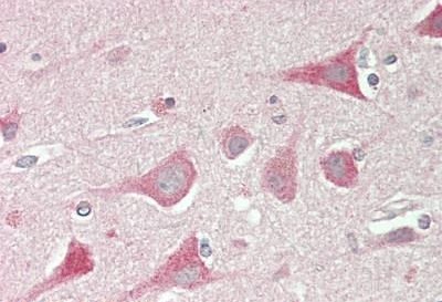 Immunohistochemistry (Formalin/PFA-fixed paraffin-embedded sections) - Anti-Profilin 2 antibody (AB230673), expandable thumbnail