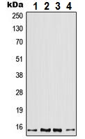 Western blot - Anti-Profilin 2 antibody (AB230673), expandable thumbnail