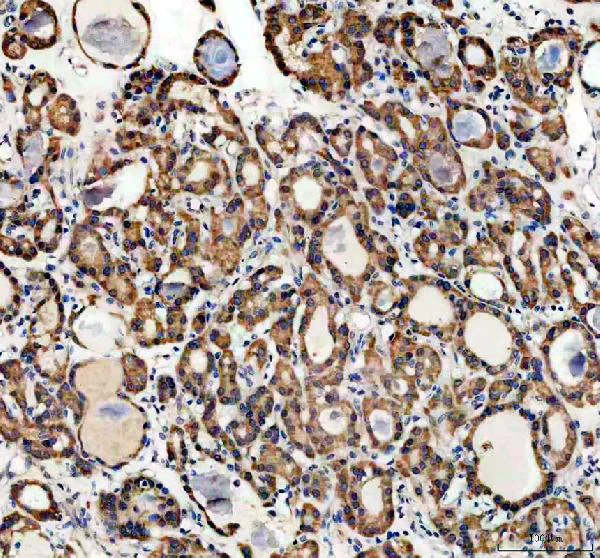 Immunohistochemistry (Formalin/PFA-fixed paraffin-embedded sections) - Anti-Profilin 2 antibody - C-terminal (AB191054)