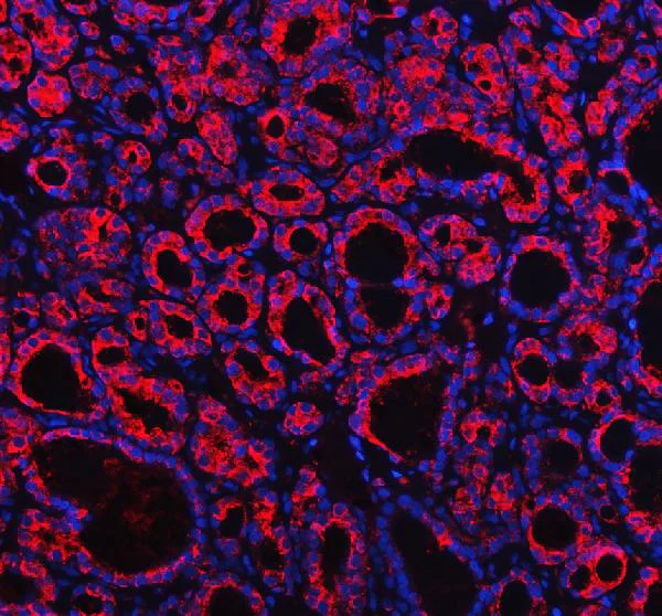 Immunohistochemistry (Formalin/PFA-fixed paraffin-embedded sections) - Anti-Profilin 2 antibody - C-terminal (AB191054)