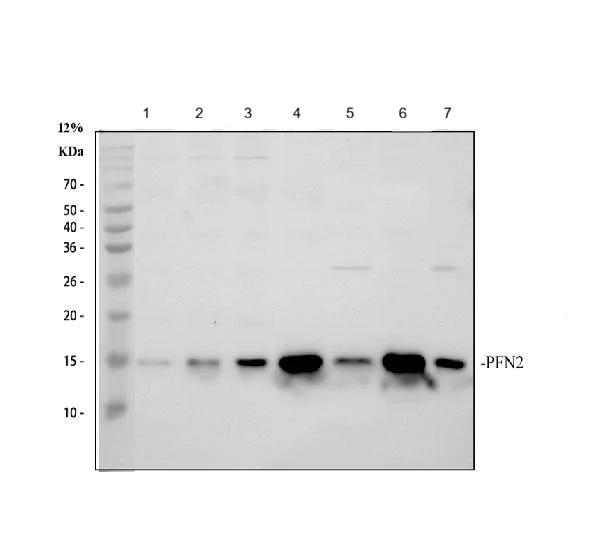 Western blot - Anti-Profilin 2 antibody - C-terminal (AB191054)