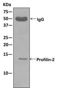 Immunoprecipitation - Anti-Profilin 2 antibody [EPR11030] - BSA and Azide free (AB249818), expandable thumbnail