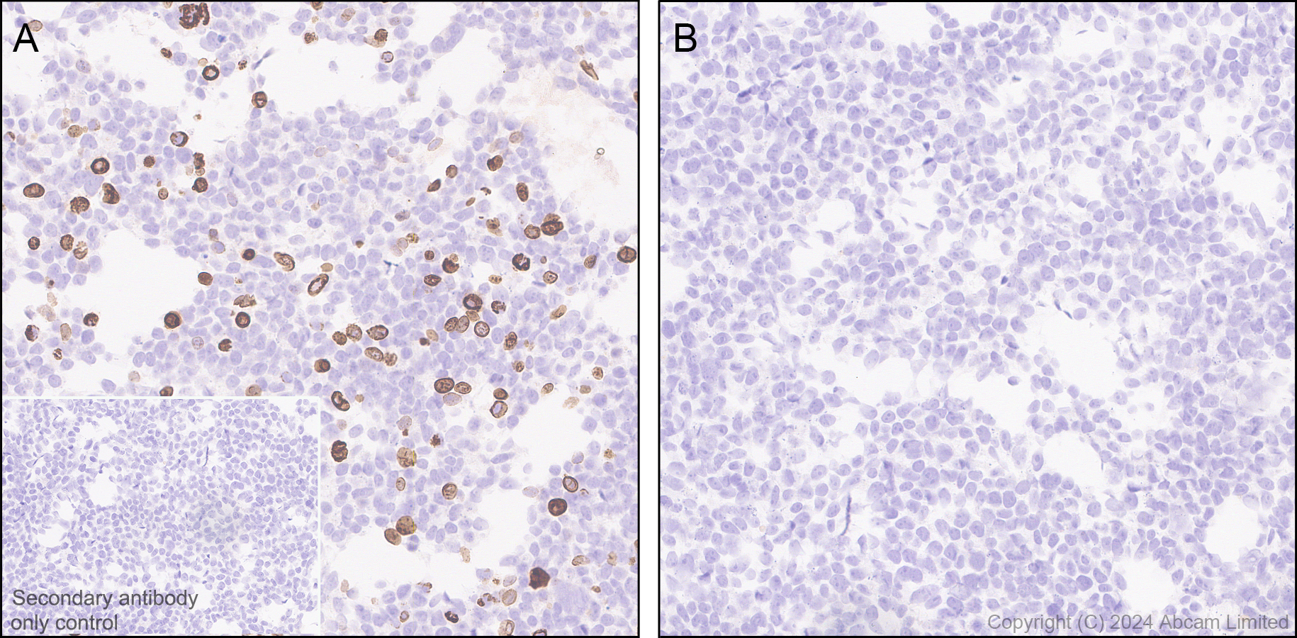 Immunohistochemistry (Formalin/PFA-fixed paraffin-embedded sections) - Anti-Progerin antibody [EPR28694-72] (AB320642), expandable thumbnail