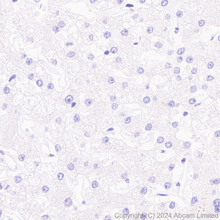 Immunohistochemistry (Formalin/PFA-fixed paraffin-embedded sections) - Anti-Progerin antibody [EPR28694-72] (AB320642), expandable thumbnail