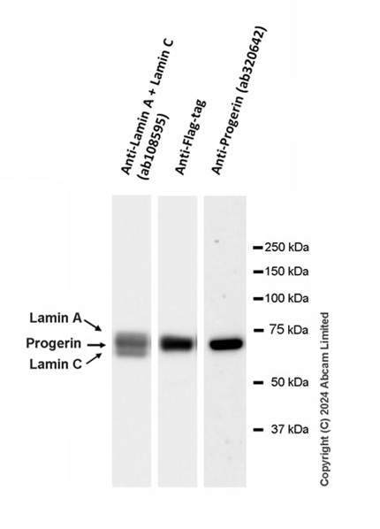 Western blot - Anti-Progerin antibody [EPR28694-72] (AB320642), expandable thumbnail