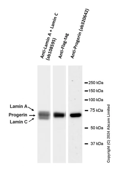 Western blot - Anti-Progerin antibody [EPR28694-72] (AB320642)