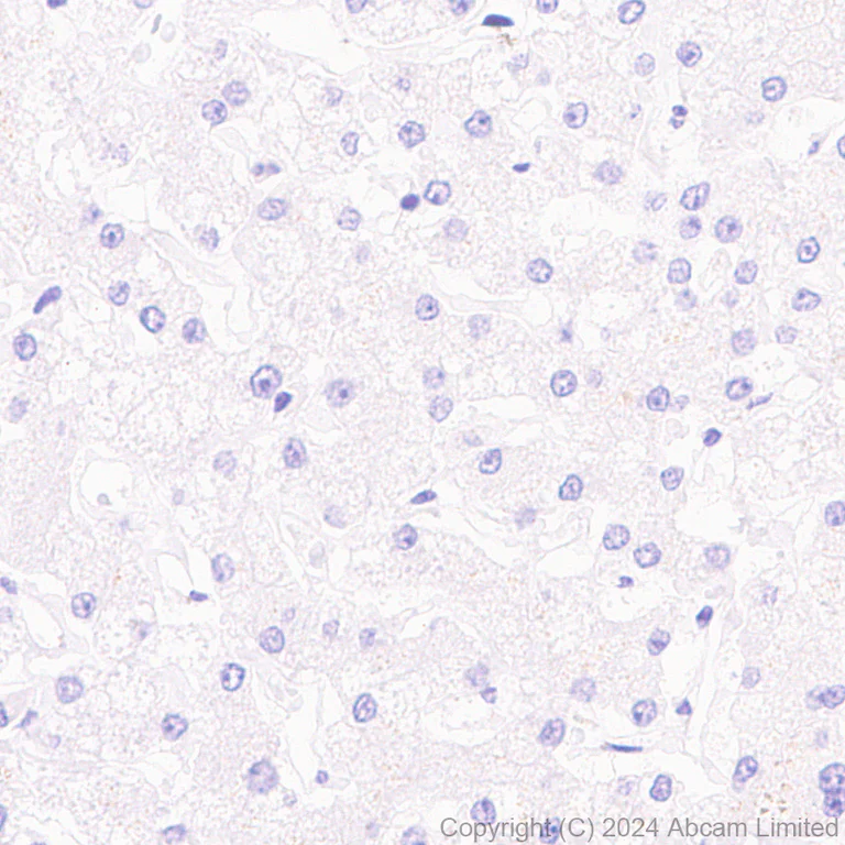 Immunohistochemistry (Formalin/PFA-fixed paraffin-embedded sections) - Anti-Progerin antibody [EPR28694-72] - BSA and Azide free (AB320643)
