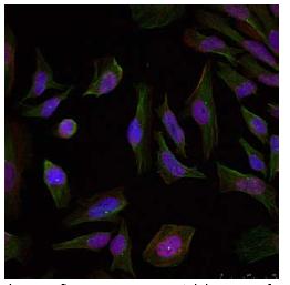Immunocytochemistry/ Immunofluorescence - Anti-Progesterone Receptor antibody (AB131486)