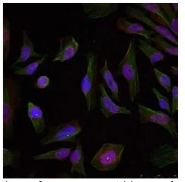 Immunocytochemistry/ Immunofluorescence - Anti-Progesterone Receptor antibody (AB131486)