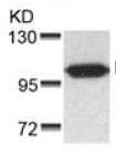 Western blot - Anti-Progesterone Receptor antibody (AB131486)