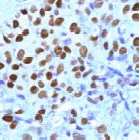 Immunohistochemistry (Formalin/PFA-fixed paraffin-embedded sections) - Anti-Progesterone Receptor antibody (AB15509)