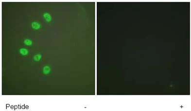 Immunocytochemistry/ Immunofluorescence - Anti-Progesterone Receptor antibody (AB63605)