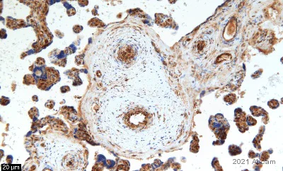 Immunohistochemistry (Formalin/PFA-fixed paraffin-embedded sections) - Anti-Progesterone Receptor antibody (AB63605)