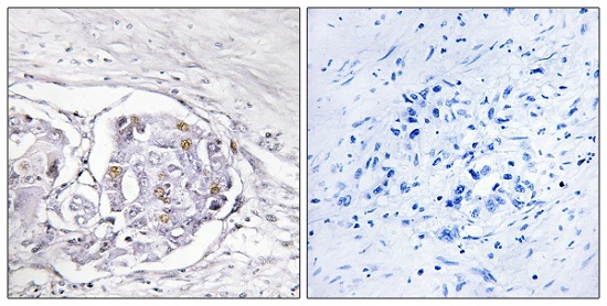 Immunohistochemistry (Formalin/PFA-fixed paraffin-embedded sections) - Anti-Progesterone Receptor antibody (AB63605)