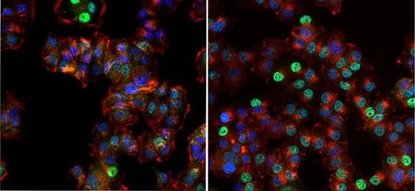 Immunocytochemistry/ Immunofluorescence - Anti-Progesterone Receptor antibody [Alpha PR6] (AB2765)