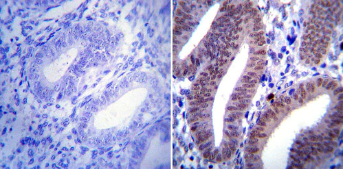 Immunohistochemistry (Formalin/PFA-fixed paraffin-embedded sections) - Anti-Progesterone Receptor antibody [Alpha PR6] (AB2765)