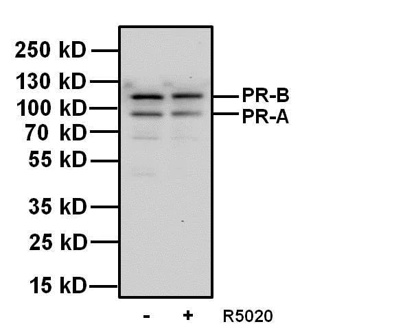 Western blot - Anti-Progesterone Receptor antibody [Alpha PR6] (AB2765)