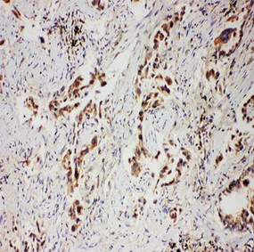 Immunohistochemistry (Formalin/PFA-fixed paraffin-embedded sections) - Anti-Progesterone Receptor antibody - C-terminal (AB191138)