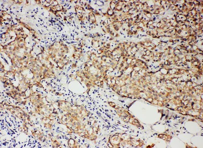 Immunohistochemistry (Formalin/PFA-fixed paraffin-embedded sections) - Anti-Progesterone Receptor antibody - C-terminal (AB191138)