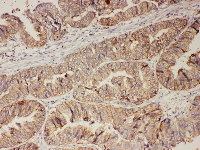 Immunohistochemistry (Formalin/PFA-fixed paraffin-embedded sections) - Anti-Progesterone Receptor antibody - C-terminal (AB191138)