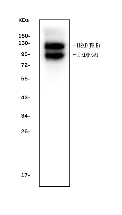 Western blot - Anti-Progesterone Receptor antibody - C-terminal (AB191138)