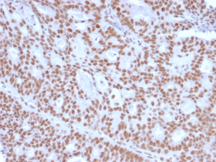 Immunohistochemistry (Formalin/PFA-fixed paraffin-embedded sections) - Anti-Progesterone Receptor antibody [PGR/2694] - BSA and Azide free (AB268223)