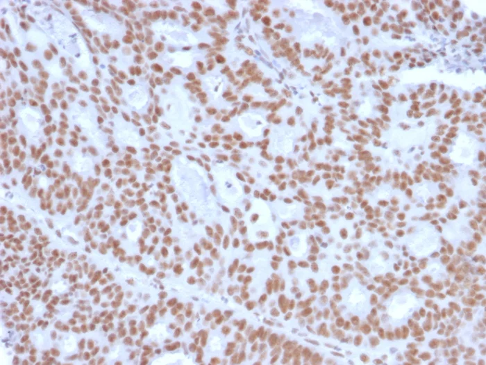 Immunohistochemistry (Formalin/PFA-fixed paraffin-embedded sections) - Anti-Progesterone Receptor antibody [PGR/2694] - BSA and Azide free (AB268223)