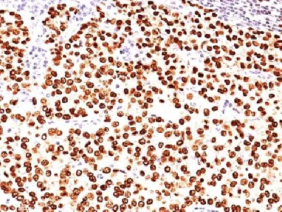 Immunohistochemistry (Formalin/PFA-fixed paraffin-embedded sections) - Anti-Progesterone Receptor antibody [PR484] - BSA and Azide free (AB212719)
