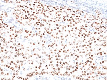 Immunohistochemistry (Formalin/PFA-fixed paraffin-embedded sections) - Anti-Progesterone Receptor antibody [PR500] - BSA and Azide free (AB269795)