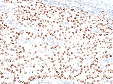 Immunohistochemistry (Formalin/PFA-fixed paraffin-embedded sections) - Anti-Progesterone Receptor antibody [PR500] - BSA and Azide free (AB269795)