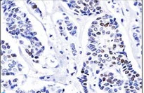 Immunohistochemistry (Formalin/PFA-fixed paraffin-embedded sections) - Anti-Progesterone Receptor antibody [PR501] - BSA and Azide free (AB269796)