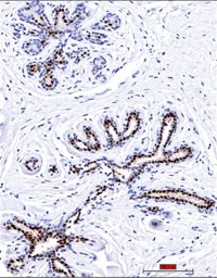 Immunohistochemistry (Formalin/PFA-fixed paraffin-embedded sections) - Anti-Progesterone Receptor antibody [PR501] - BSA and Azide free (AB269796)