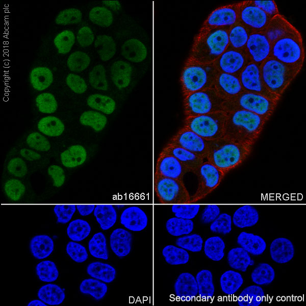 Immunocytochemistry/ Immunofluorescence - Anti-Progesterone Receptor antibody [SP2] (AB16661), expandable thumbnail