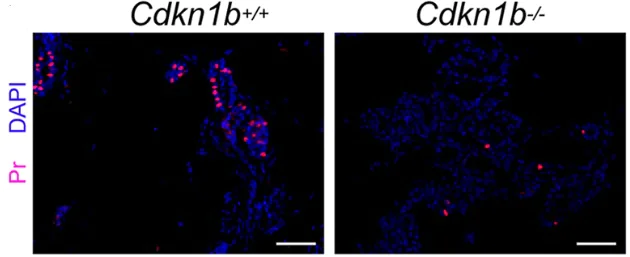 Immunocytochemistry/ Immunofluorescence - Anti-Progesterone Receptor antibody [SP2] (AB16661)