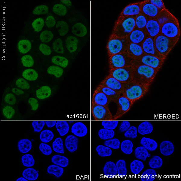 Immunocytochemistry/ Immunofluorescence - Anti-Progesterone Receptor antibody [SP2] - BSA and Azide free (AB239793)