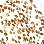 Immunohistochemistry (Formalin/PFA-fixed paraffin-embedded sections) - Anti-Progesterone Receptor antibody [SP2], prediluted (AB27596)