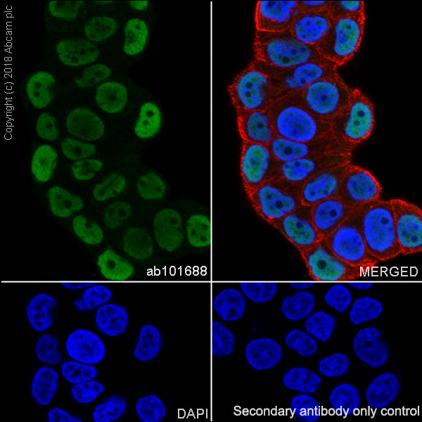 Immunocytochemistry/ Immunofluorescence - Anti-Progesterone Receptor antibody [SP42] (AB101688), expandable thumbnail